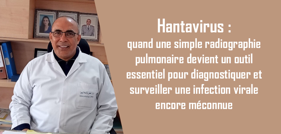 Hantavirus: quand une simple radiographie pulmonaire devient un outil essentiel pour diagnostiquer et surveiller une infection virale encore méconnue