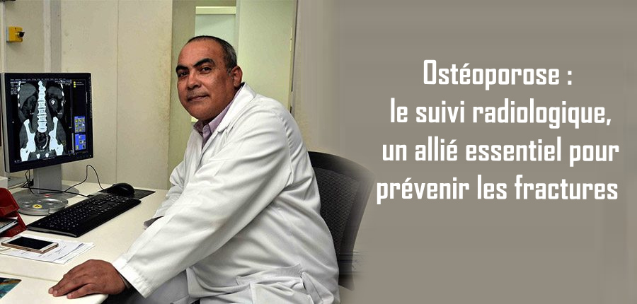 Ostéoporose: le suivi radiologique, un allié essentiel pour prévenir les fractures