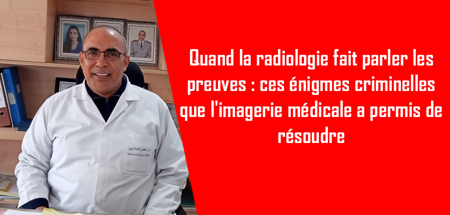 Quand la radiologie fait parler les preuves: ces énigmes criminelles que l'imagerie médicale a permis de résoudre