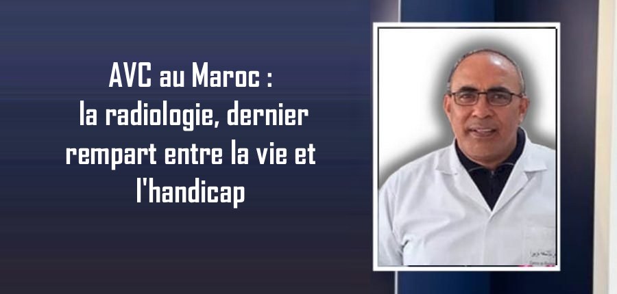 AVC au Maroc : la radiologie, dernier rempart entre la vie et l'handicap