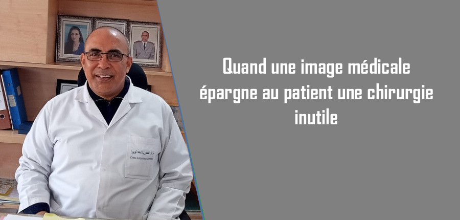 Quand une image médicale épargne au patient une chirurgie inutile