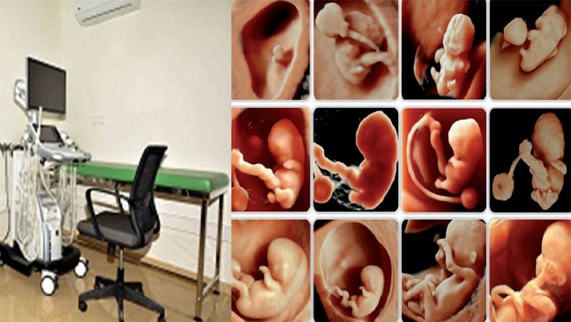 echographie 3d 28052018