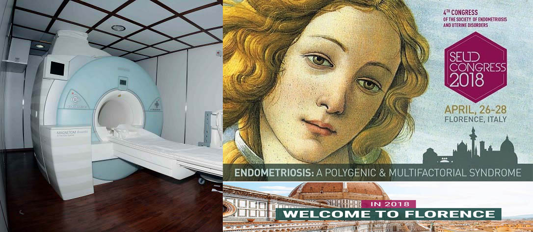 endometriosis 26282018