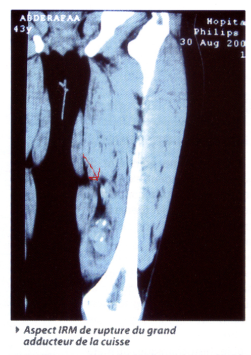 photo1 p74