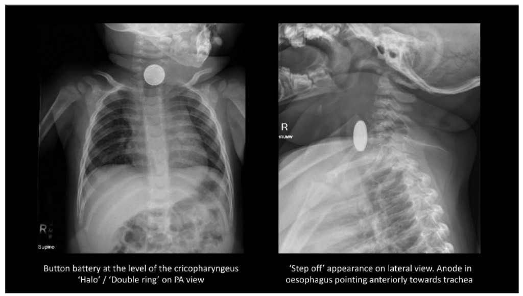 pile bouton 2703202401