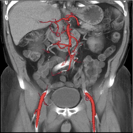progres imagerie medicale 03